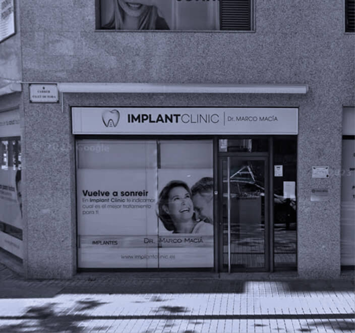 elche implant clinic